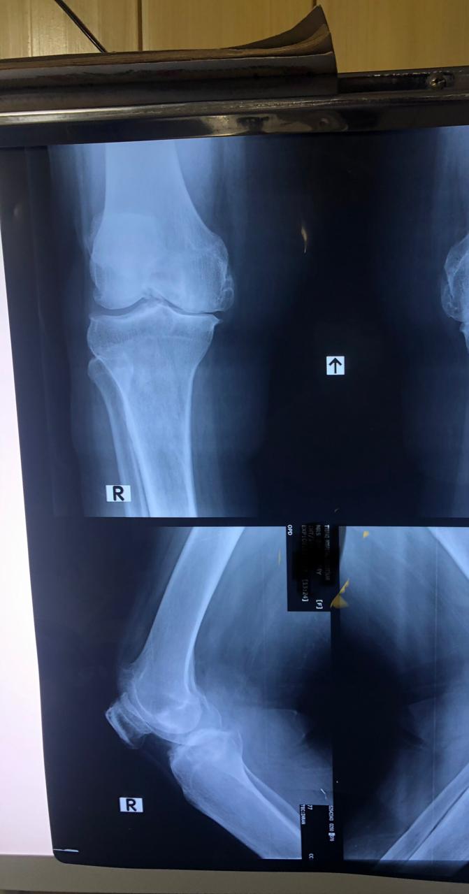 WhatsApp Image 2026-02-02 at 8.24.18 PM