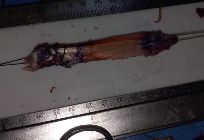 WhatsApp Image 2026-02-02 at 8.32.32 PM