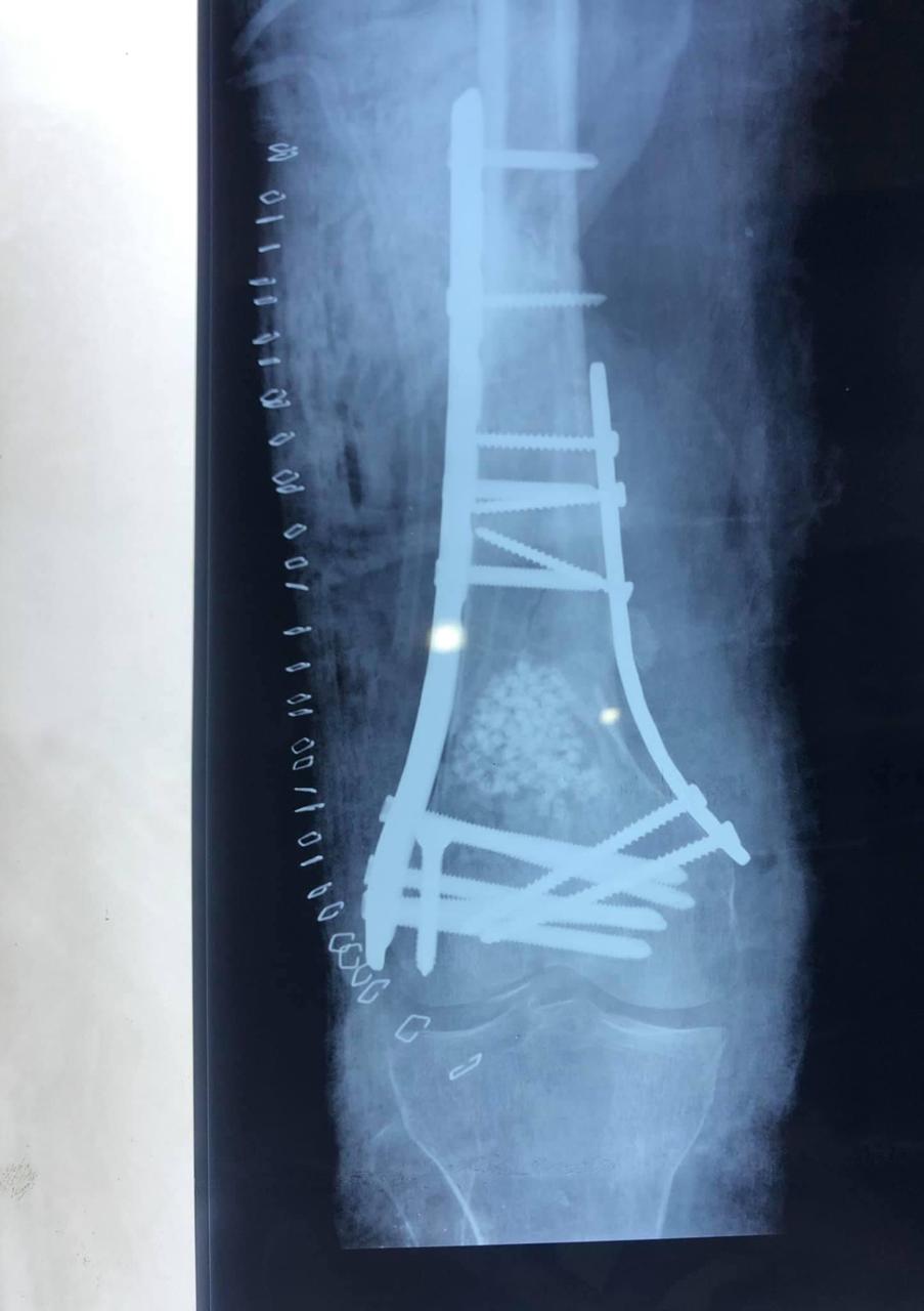 WhatsApp Image 2026-02-03 at 11.58.57 AM