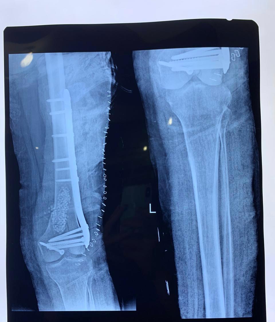 WhatsApp Image 2026-02-03 at 11.58.58 AM (1)