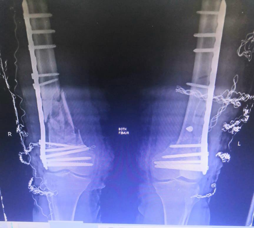 WhatsApp Image 2026-02-03 at 11.58.58 AM